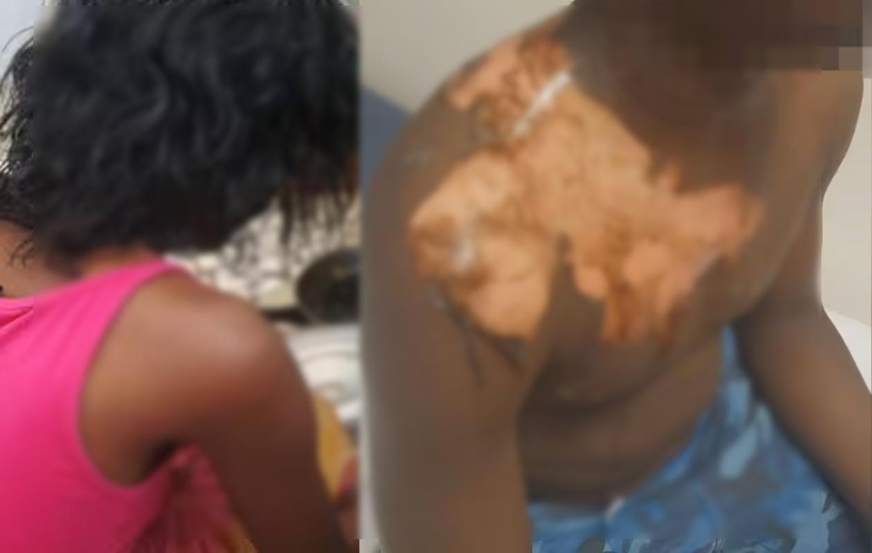 Ross-Béthio : une jeune dame de 18 ans ébouillante son mari et sa coépouse pour «mettre fin à son mariage forcé»